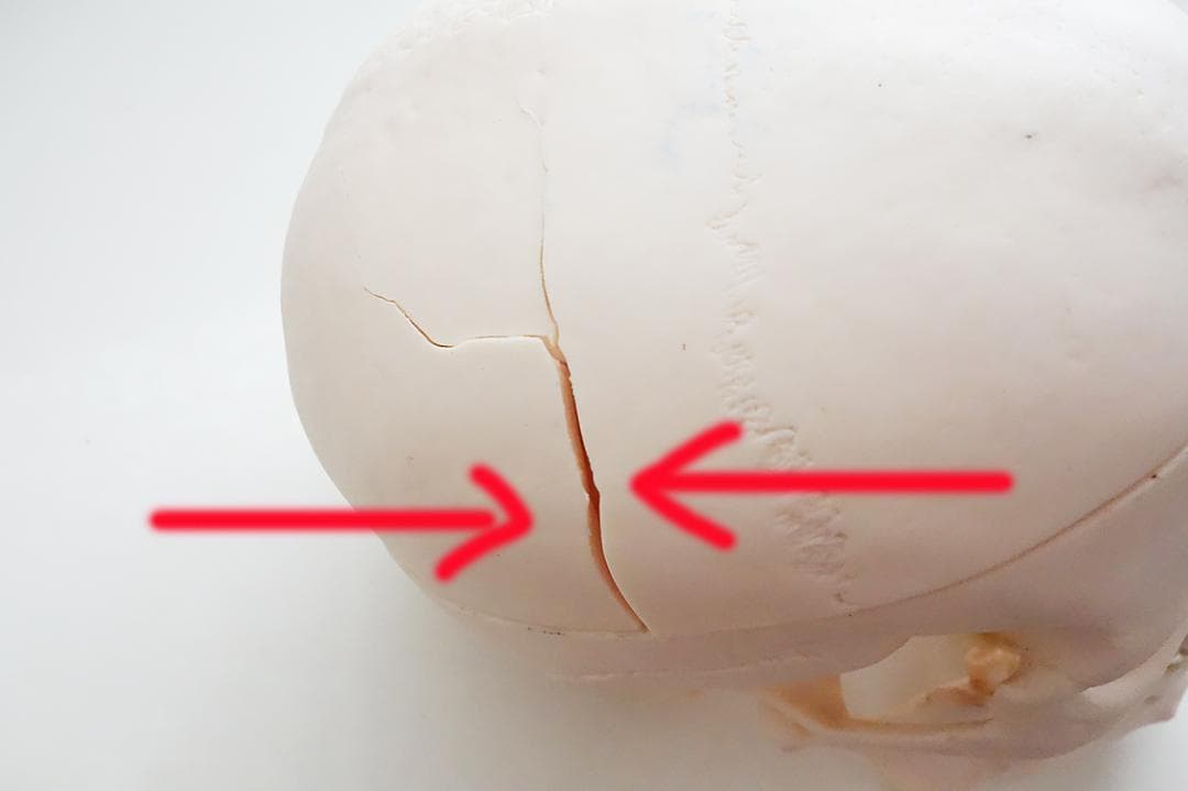 頭蓋骨 模型 ソムソ SOMSO 社製 Z13 - メルカリ