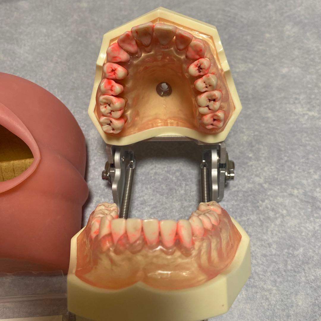 NISSIN DENTAL MODEL 顎模型 頬粘膜 舌付 - メルカリ