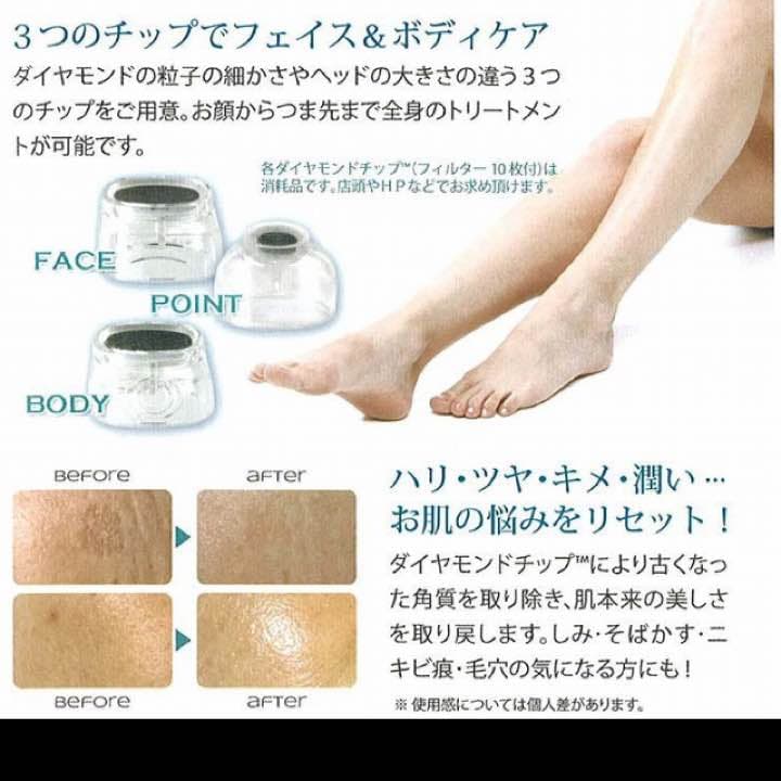 ダイヤモンドピーリング