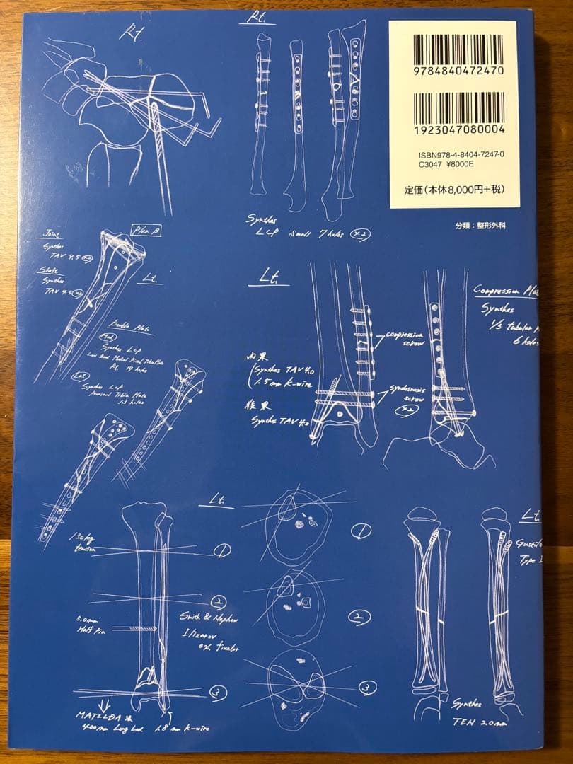 裁断済】骨折の術前計画 55
