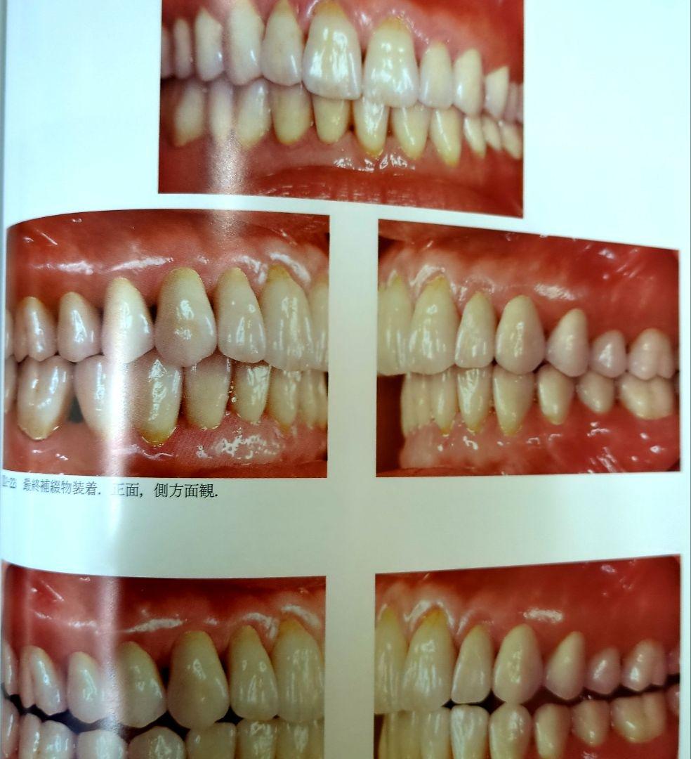 ザ・プロビジョナルレストレーションズ - メルカリ