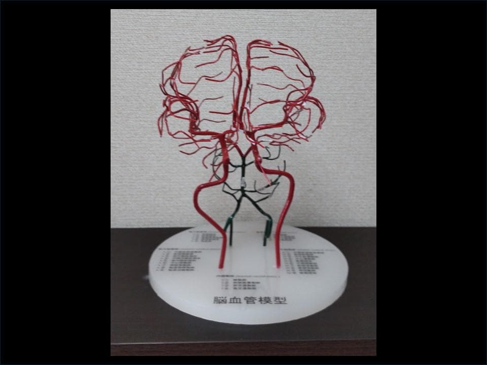 脳血管模型（内頚動脈、椎骨動脈） 脳血管模型(内頚動脈・椎骨動脈・脳静脈) - メルカリ