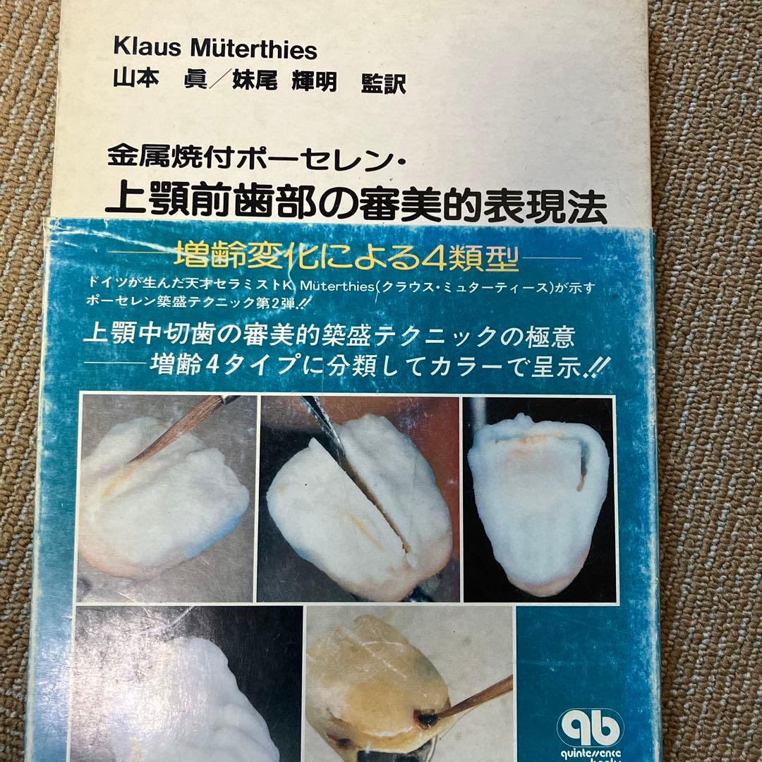 金属焼付ポーセレン 上顎前歯部の審美的表現法　歯科技工 審美歯科に使われる素材について理事長と歯科技工士さんが徹底解説