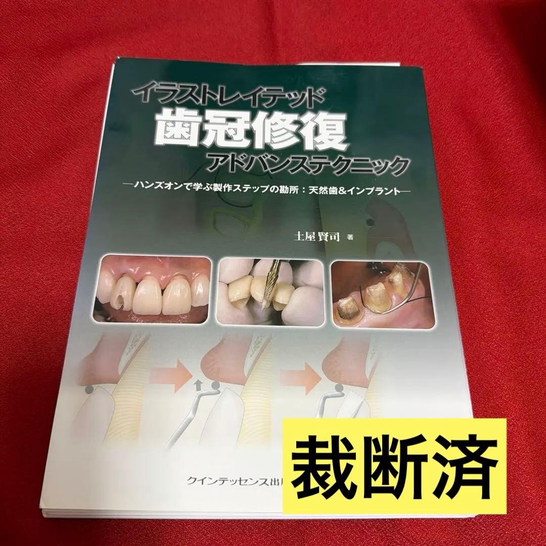 【裁断済】イラストレイテッド歯冠修復アドバンステクニック : ハンズオンで学ぶ 楽天市場】イラストレイテッド歯冠修復アドバンステクニックの通販