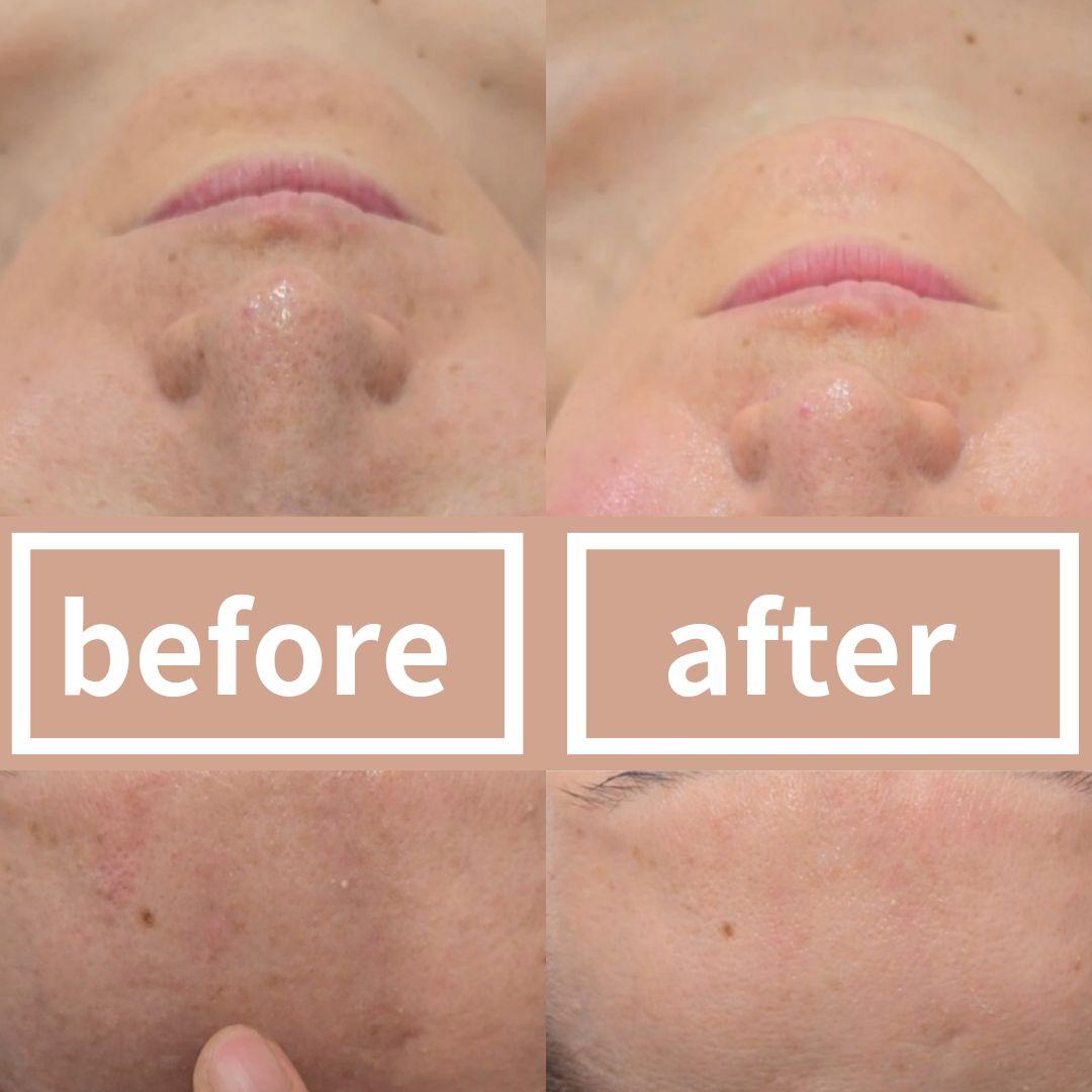 最新版】『ララピール504成分入り』1箱ベーシック▪︎ウルトラ各1本