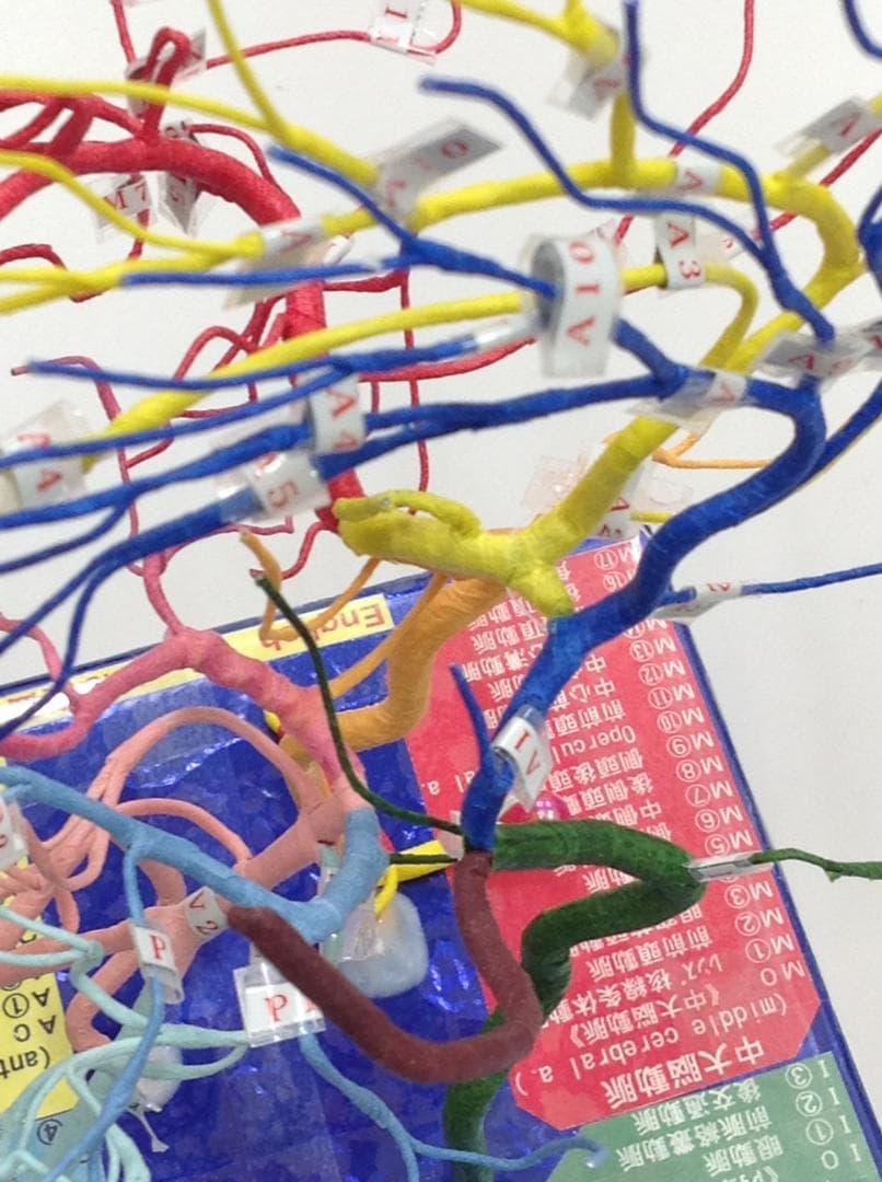 脳血管模型（作れない必要な人のために）教育用 TYPE.Hiro.No99