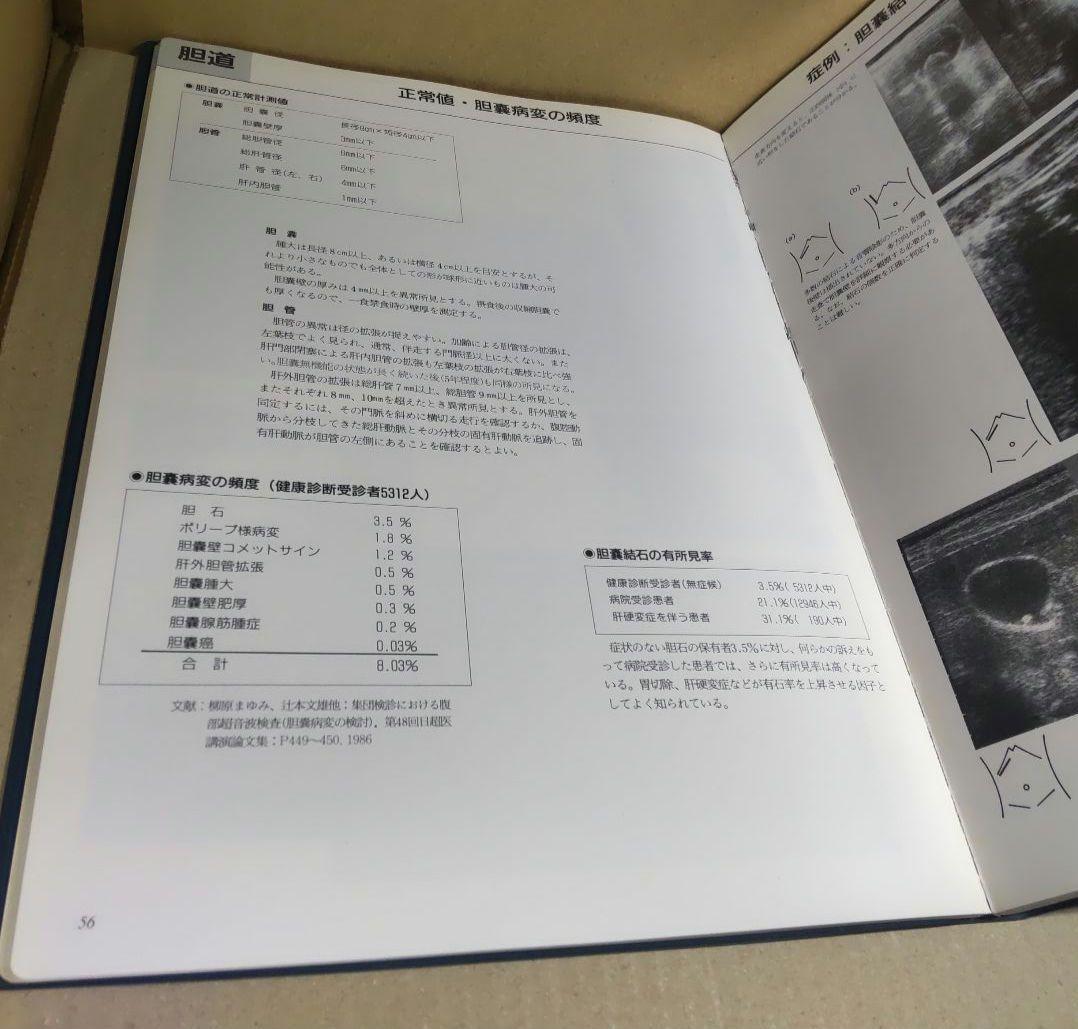 腹部超音波テキスト 上・下腹部 改訂版 ベクトル・コア - メルカリ