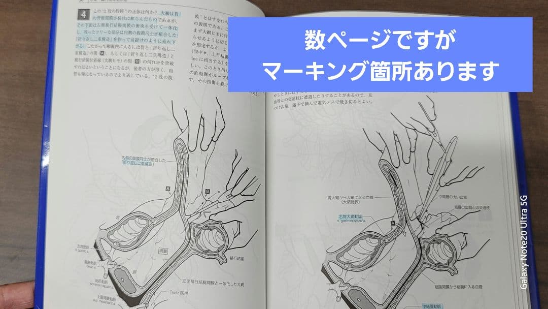 廃盤 イラストレイテッド外科手術 第3版コンパクト版 - メルカリ