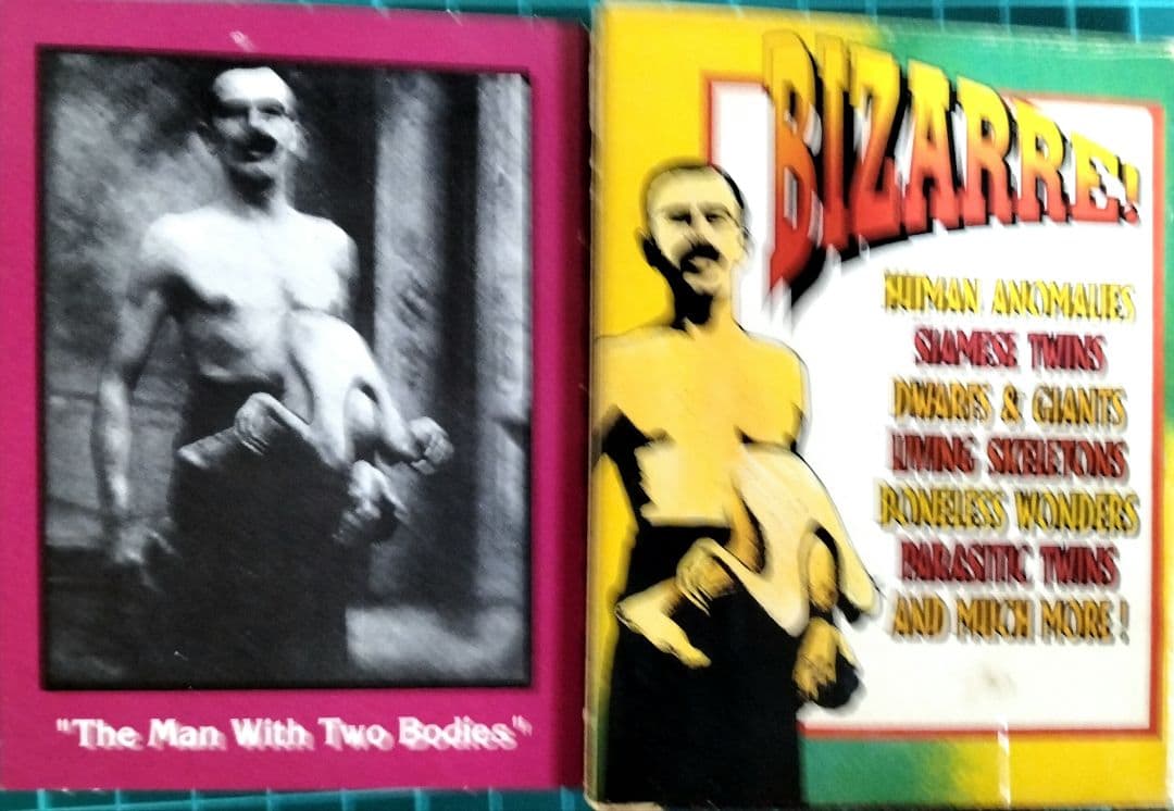 フリークスカード 畸形 見世物小屋 異端 米国製 『希少品』