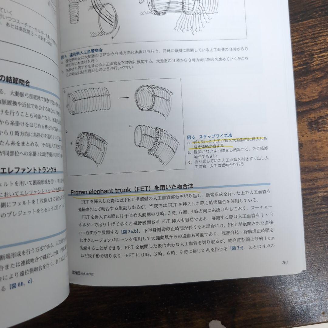 心臓血管外科手術虎の巻 - メルカリ
