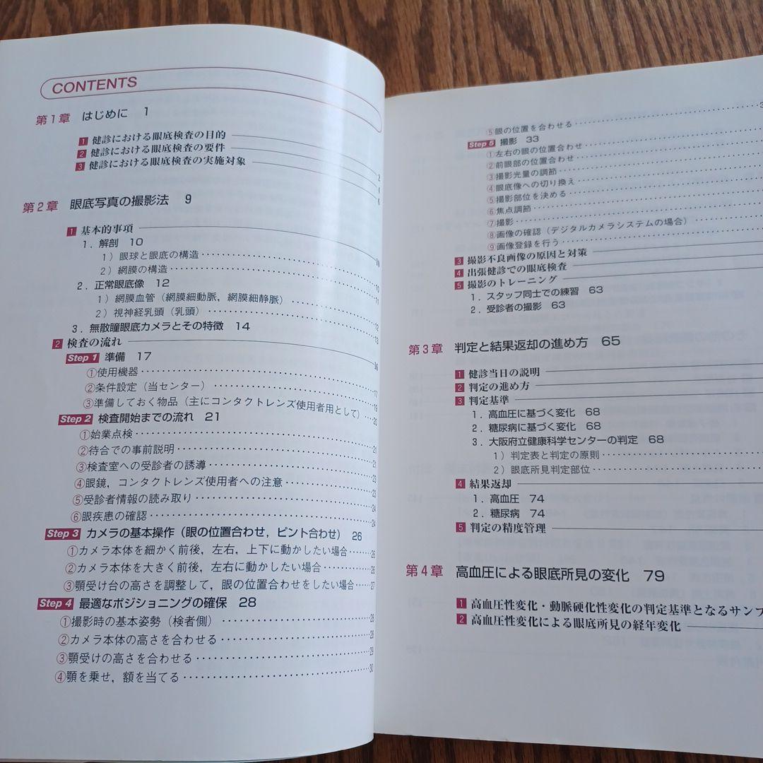 手にとるようにわかる健診のための眼底検査 : 無散瞳カメラによる撮影