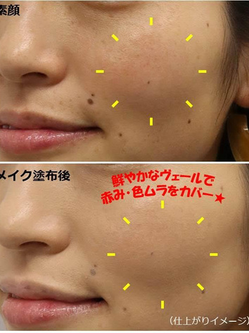 コスメデコルテ AQ ミリオリティ リペア トリートメント セラム